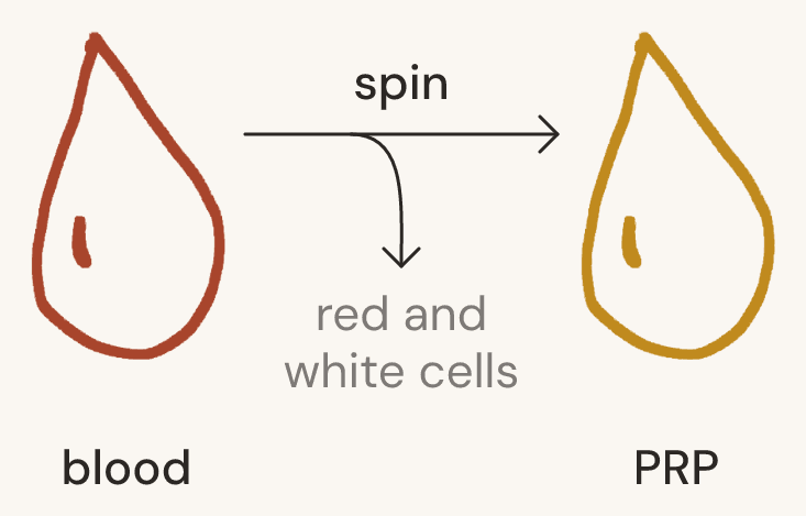 A red drop labelled blood and a gold drop labelled PRP, with an arrow marked spin between them and a second arrow carrying away the red and white cells.