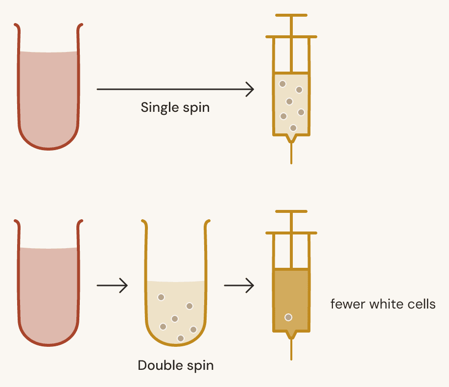 Single spin takes blood straight to a syringe that still carries white cells. Double spin passes it through a second tube first, and the syringe ends with fewer.